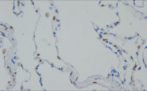 TUNEL: Assessment for cell damages results in apoptosis 